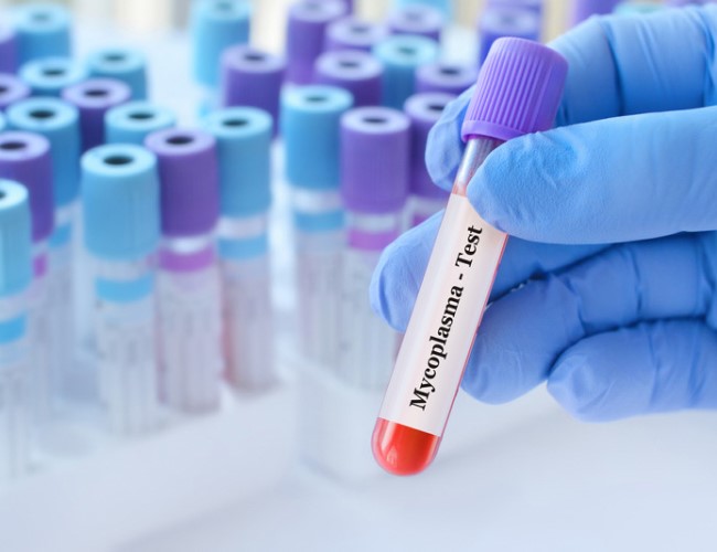 Mycoplasma ve Ureaplasma