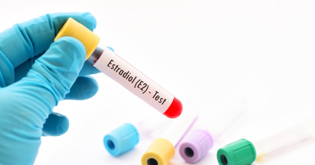 Estradiol E2 Testi