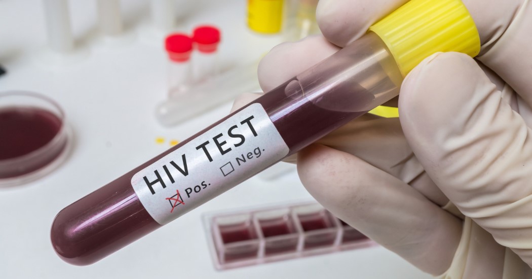HIV Combo Testi